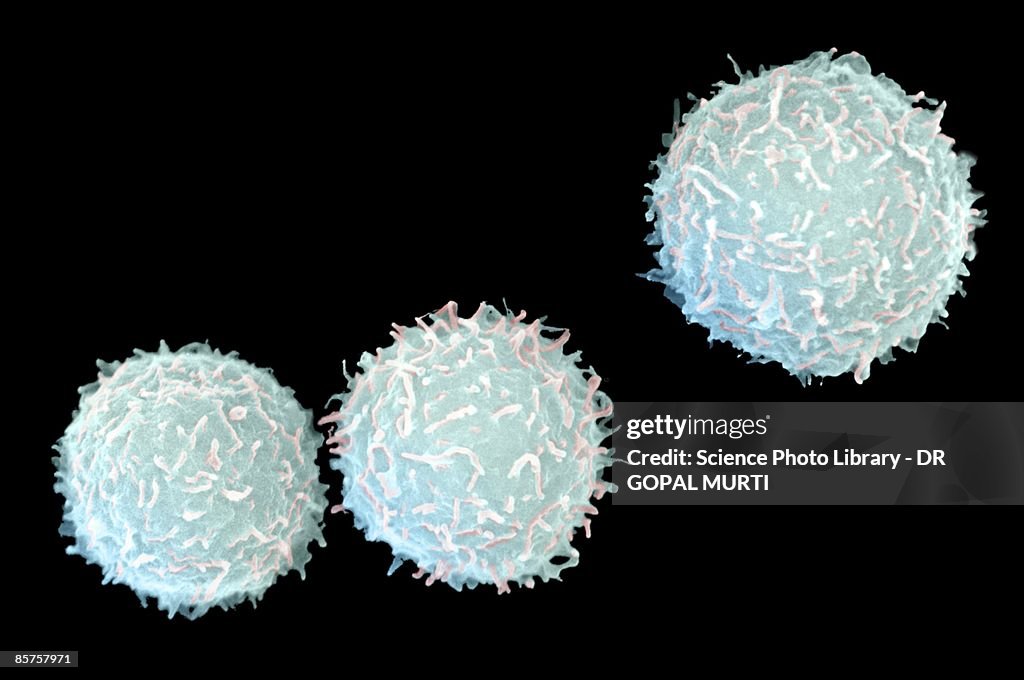 Scanning electron microscope (SEM) of white blood cell