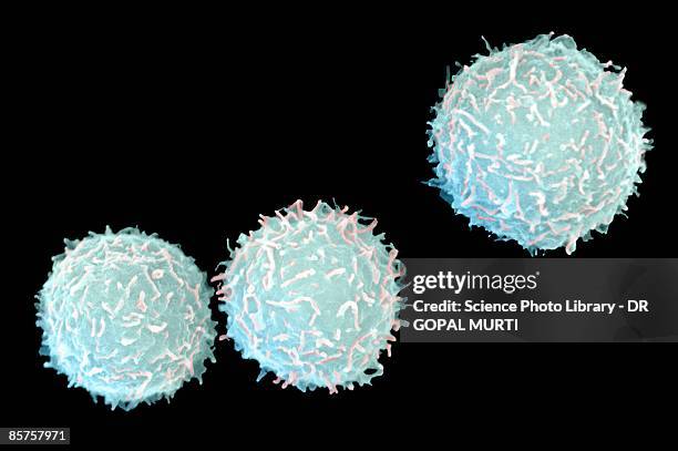 scanning electron microscope (sem) of white blood cell - scanning electron micrograph stock pictures, royalty-free photos & images