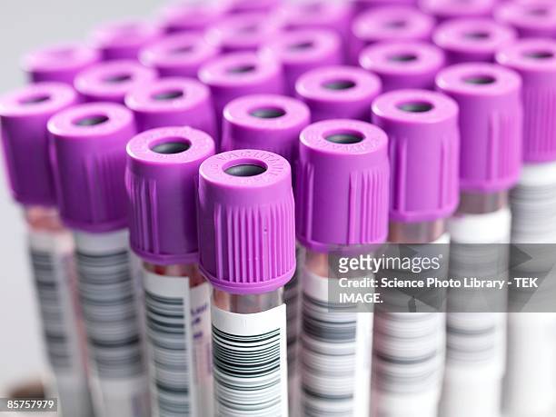 blood samples containers with bar code on it - blood tubes stock pictures, royalty-free photos & images