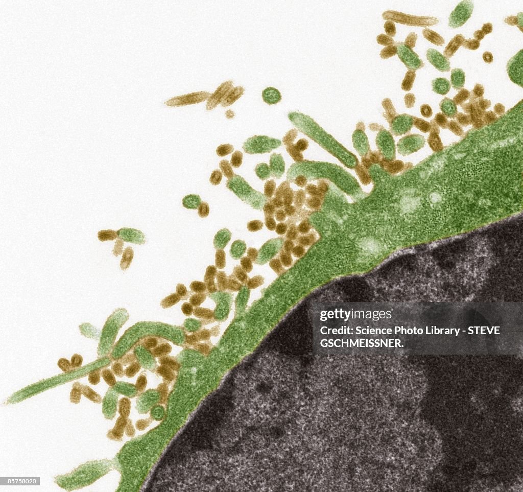 Influenza virus, scanning electron microscope (SEM)