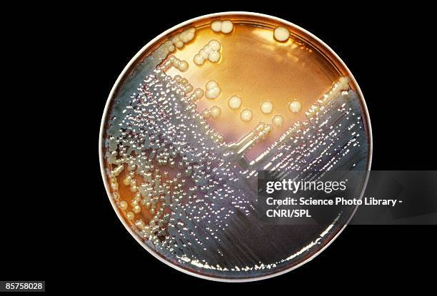 enterobacter bacteria - agargel stock-fotos und bilder