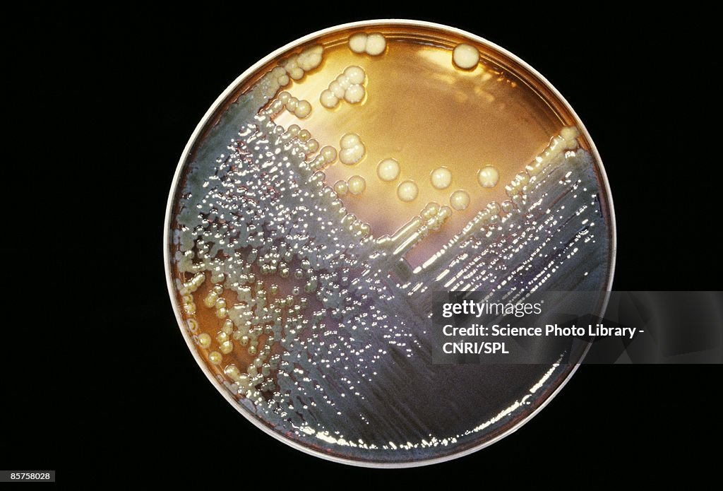 Enterobacter bacteria