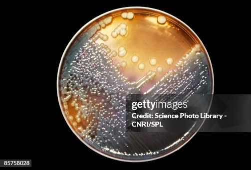 Is Enterobacter A Urease Producing Bacteria Enterobacter Bacteria High-Res Stock Photo - Getty Images