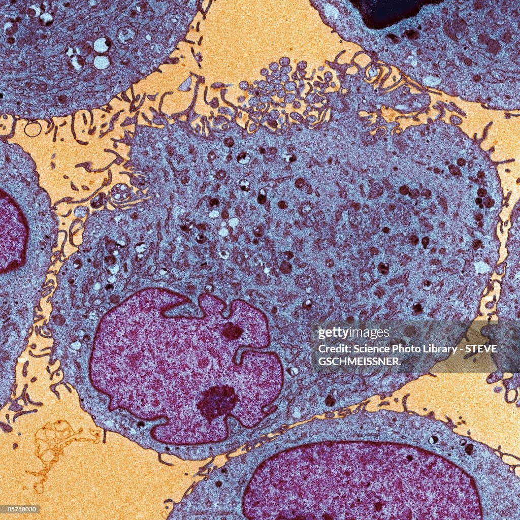 Leukemia cells