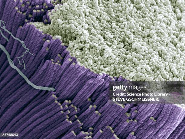 tendon, colored scanning electron micrograph(sem) - micrografía electrónica escaneadora fotografías e imágenes de stock