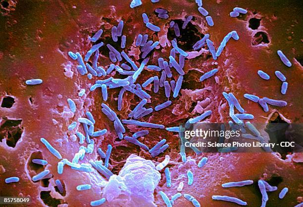 mycobacterium chelonae bacteria, colored scanning electron micrograph (sem) - batterio gram positivo foto e immagini stock