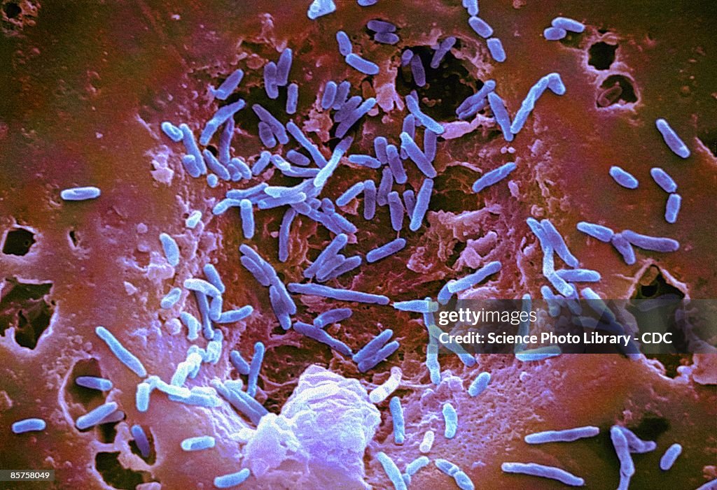 Mycobacterium chelonae bacteria, colored scanning electron micrograph (SEM)