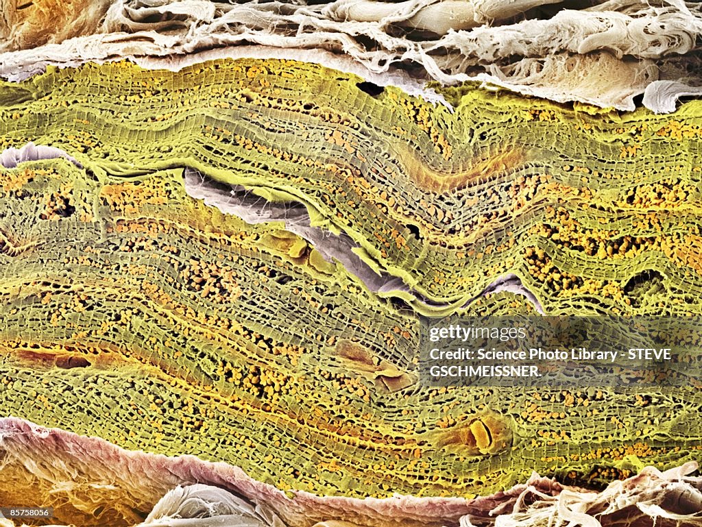 Scanning electron micrograph (SEM) of mitochondrion