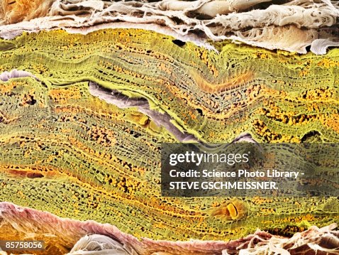Scanning electron micrograph (SEM) of mitochondrion Scanning electron micrograph (SEM) of mitochondrion