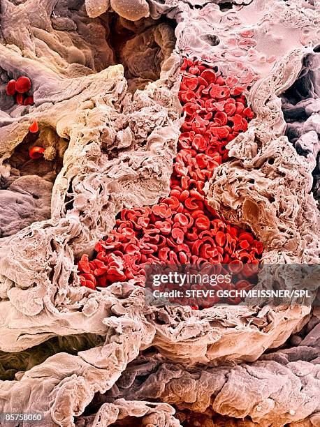 lung blood vessel - haarvat stockfoto's en -beelden