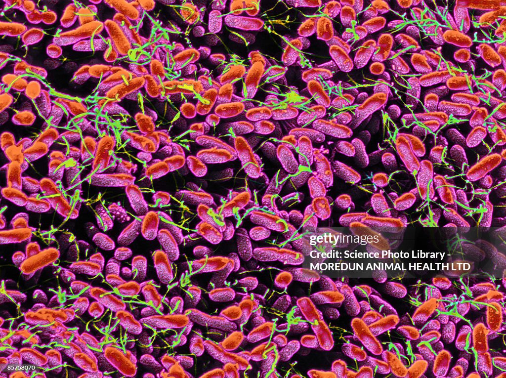 Colored scanning electron micrograph (SEM) of many bacteria growing on blood aga