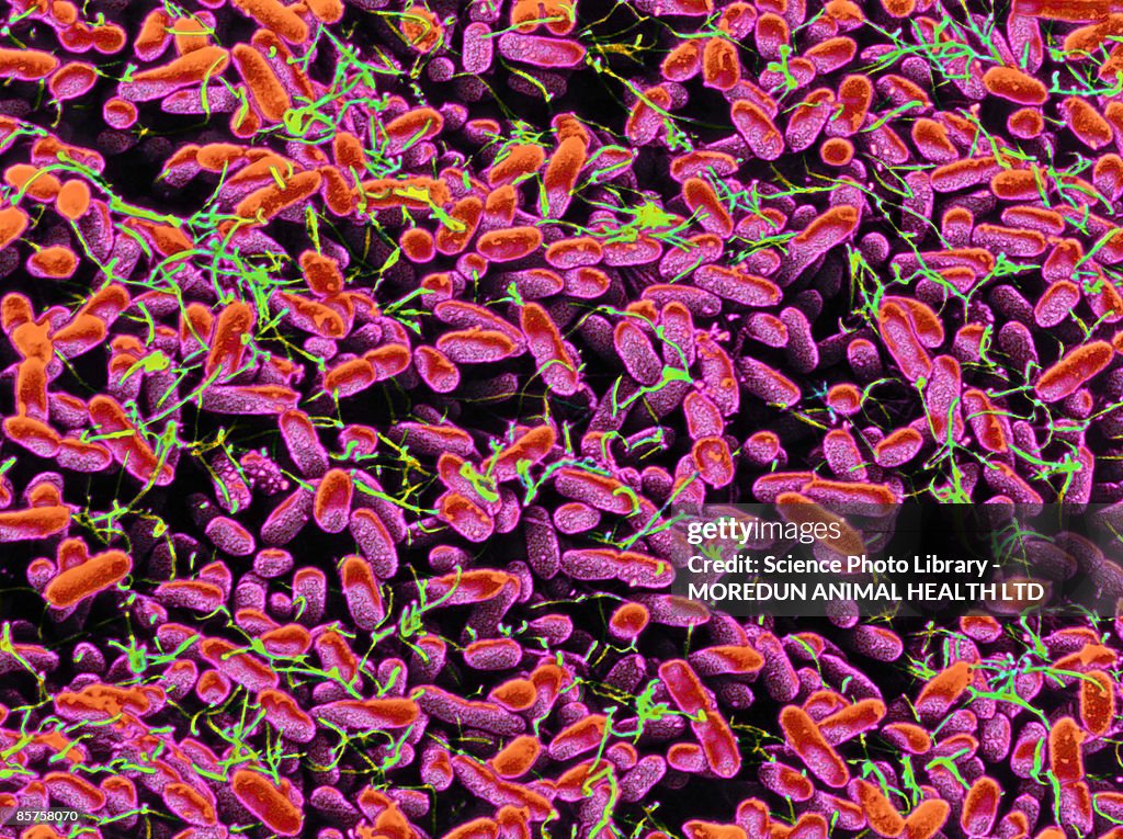 Colored scanning electron micrograph (SEM) of many bacteria growing on blood aga