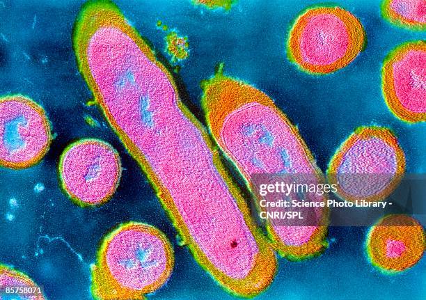 colored trans-mission electron micrograph (tem) - micrografía científica fotografías e imágenes de stock