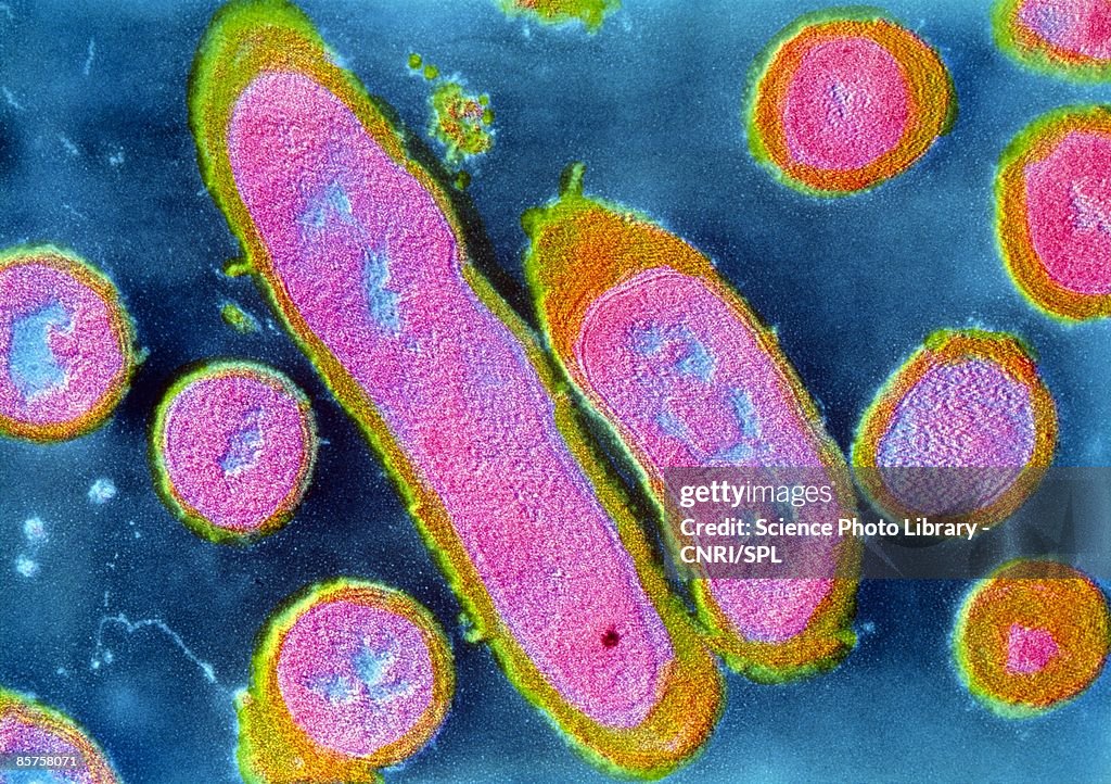 Colored trans-mission electron micrograph (TEM)