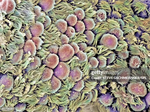 fallopian tube - sem stock pictures, royalty-free photos & images