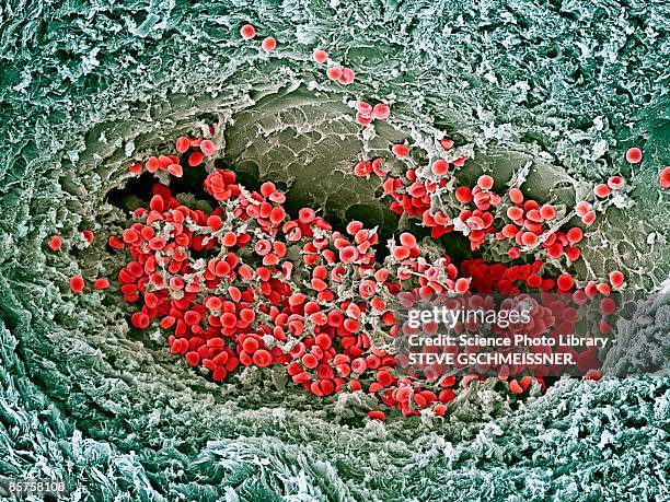 scanning electron microscope (sem) of red blood cell - fibrin fotografías e imágenes de stock