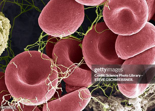 blood clot, colored scanning electron micrograph (sem) - elektronenmikroskop stock-fotos und bilder
