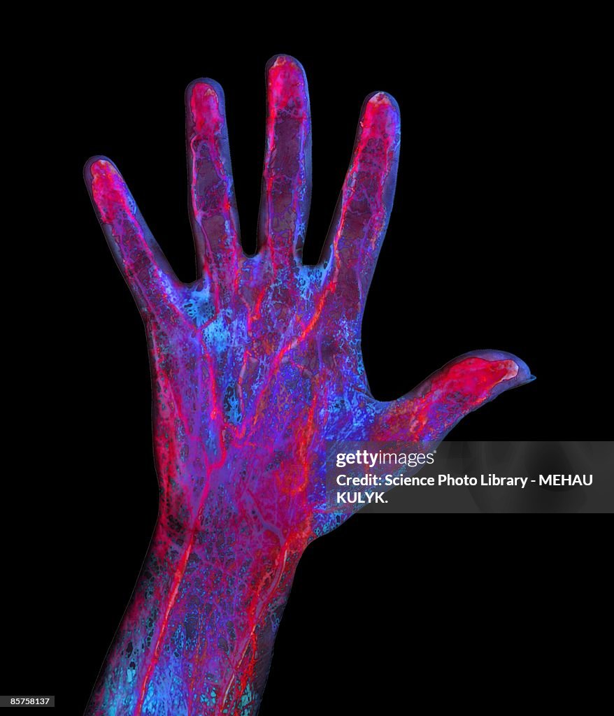 Hand blood supply