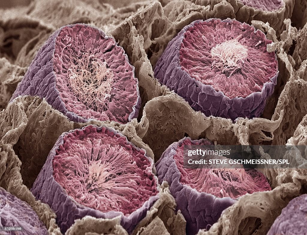 Sperm production. Scanning electron microscope (SEM)