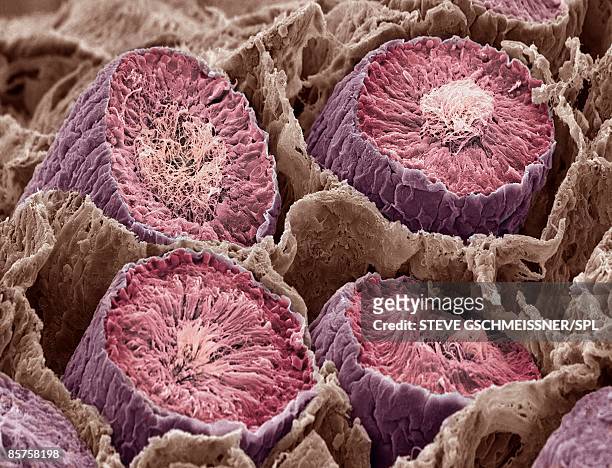 sperm production. scanning electron microscope (sem) - human gland 個照片及圖片檔