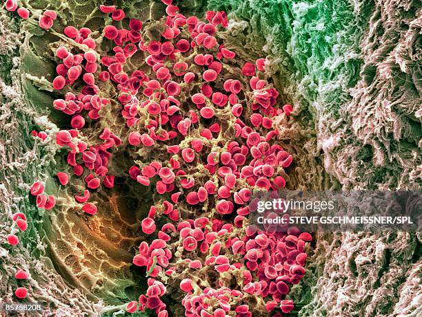 scanning electron microscope (sem) of red blood cell - fibrin - fotografias e filmes do acervo