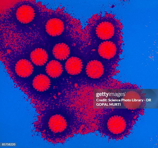 rotavirus, transmission electron micrograph (tem) - gastroenteritis stock-fotos und bilder