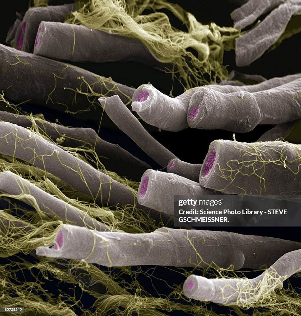 Myelinated nerve fibers