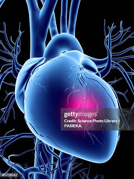 heart attack, conceptual computer artwork - heart disease stock illustrations
