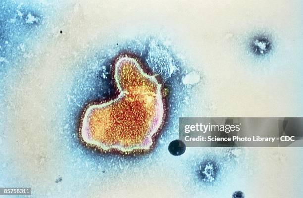 pneumonia, transmission electron micrograph (tem) - tem stock pictures, royalty-free photos & images