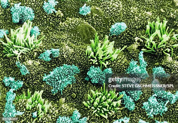 Uterus High-Res Stock Photo