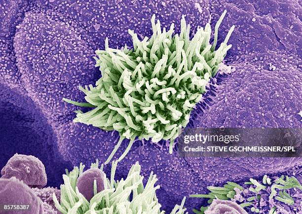 trachea lining, colored scanning electron micrograph - traquea fotografías e imágenes de stock