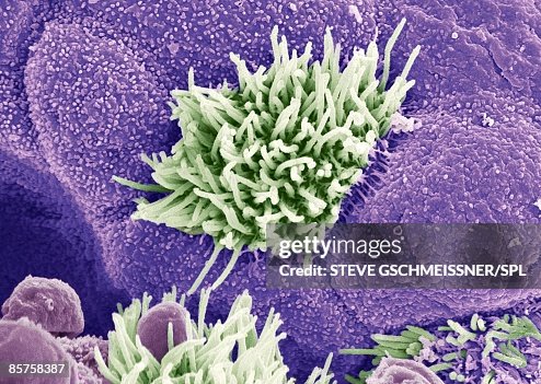 Trachea lining, colored scanning electron micrograph Trachea lining, colored scanning electron micrograph