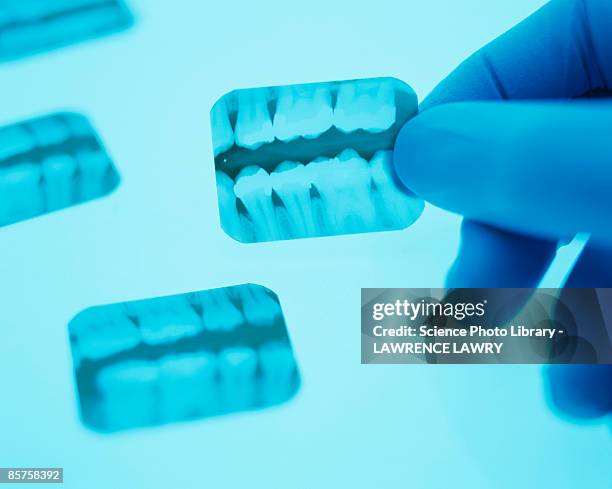 hand holding dental x-ray - surgical glove holding hand stock pictures, royalty-free photos & images