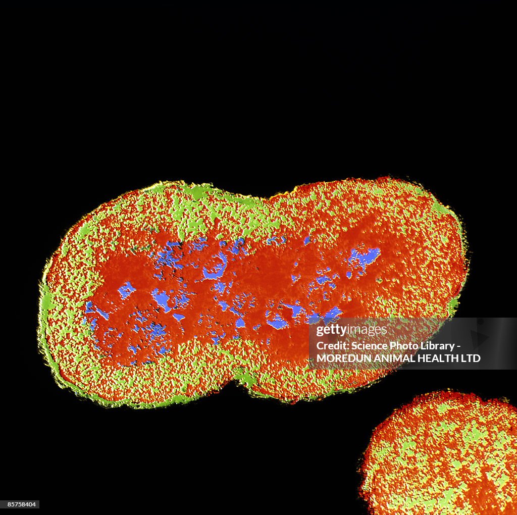 False-color shadow transmission electron micro-graph (TEM)