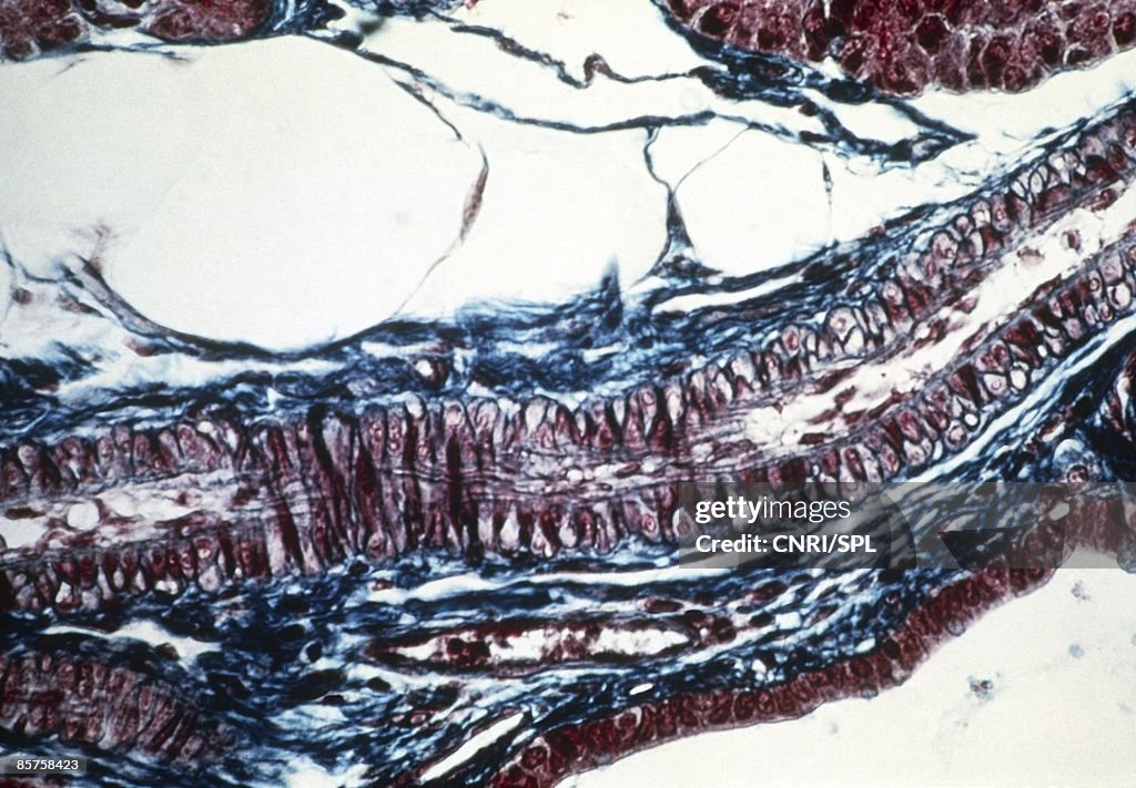 Light micrograph of human artery
