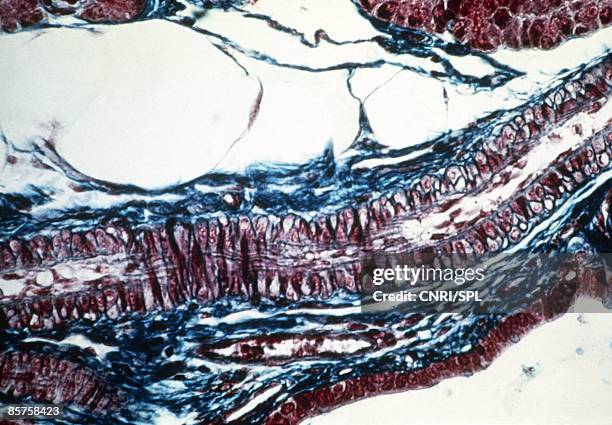 light micrograph of human artery - arterioles stock pictures, royalty-free photos & images