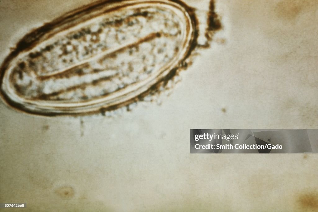 Pinworm Eye Light micrograph of a human pinworm egg, the parasite responsible for ...