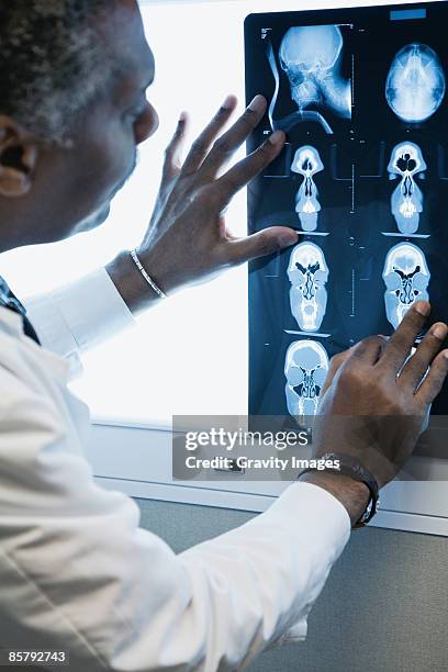 senior african american doctor studying brain scan - xray light box stock pictures, royalty-free photos & images