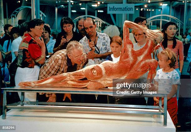 An anatomical specimen created by Professor Gunter Von Hagens is displayed March 20, 2002 at The Atlantis Gallery in the Old Truman Brewery in...