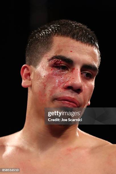Christian Gonzalez paces the ring after getting a cut on his eye by Gamaliel Diaz in the eighth round during their Super Lightweight fight at Belasco...