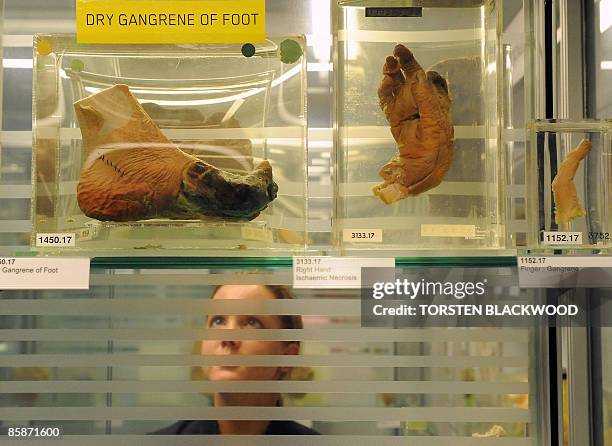 Visitor gazes at severed body parts in the gangrene section of the Museum of Human Disease at the University of New South Wales in Sydney on April 2,...