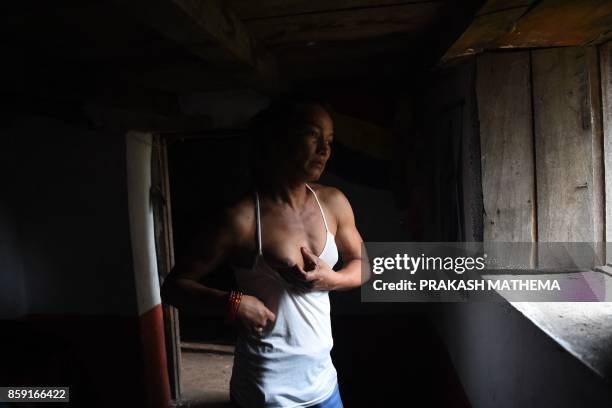 This photo taken on August 23, 2017 shows Nepali transgender person Monika Shahi Nath posing to reveal the effect of hormone drugs at Kain Pani...