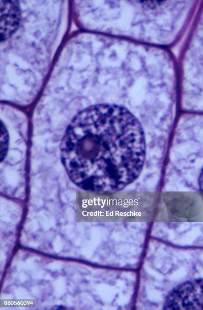 non-dividing cell--interphase, onion 500x - nucleolus stockfoto's en -beelden