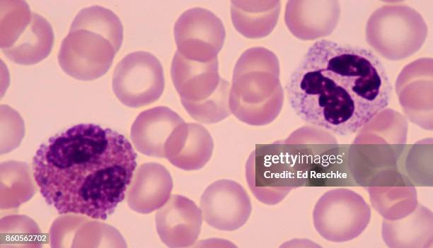 two white blood cells or leukocytes--neutrophil (right) and eosinophil (left), human blood smear, 500x - granulozyt stock-fotos und bilder