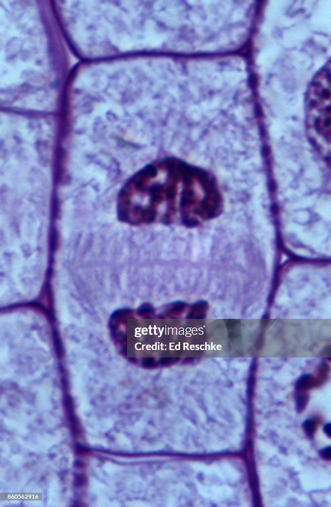 Neanthal Rottip Telophase Onion Root Tip