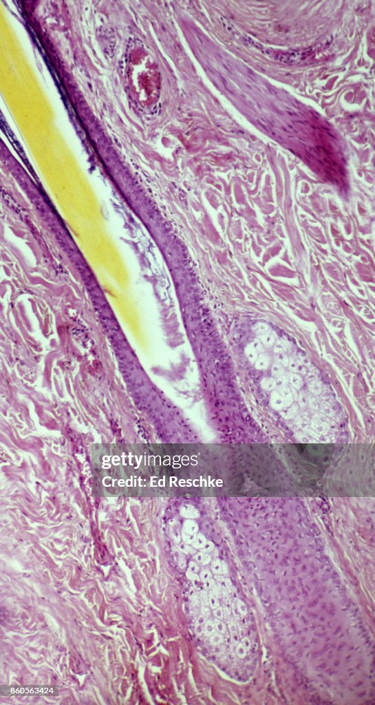 Hair Follicle, Sebaceous Glands and Arrector Pili Muscle--Human Scalp, 25X