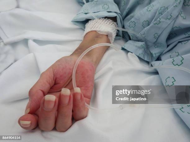 hand of a sick woman receiving dripping medication on her arm - ストレプトミセス ストックフォトと画像