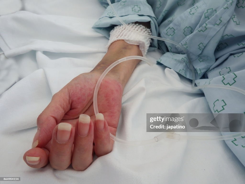 Hand of a sick woman receiving dripping medication on her arm