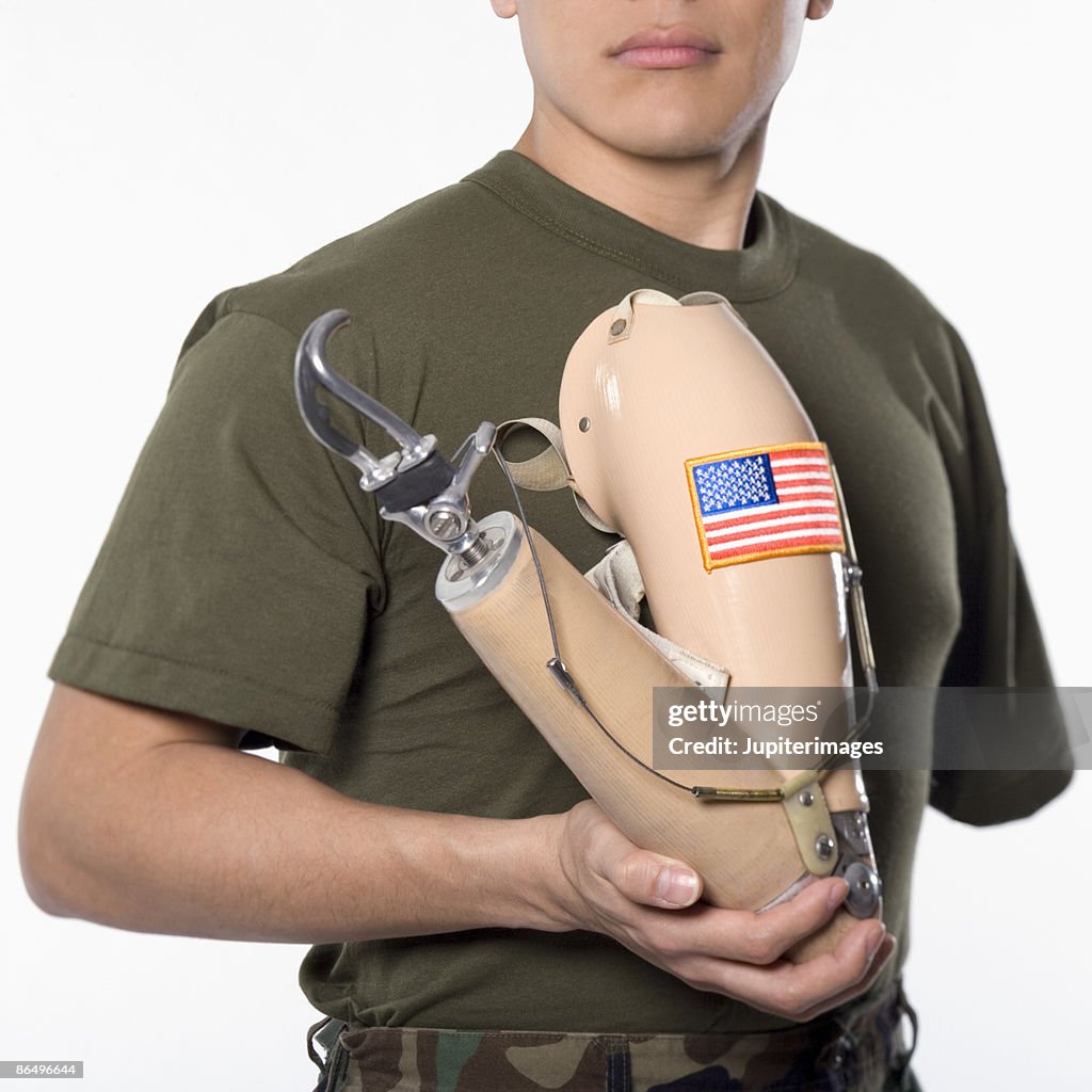 Man holding prosthetic arm