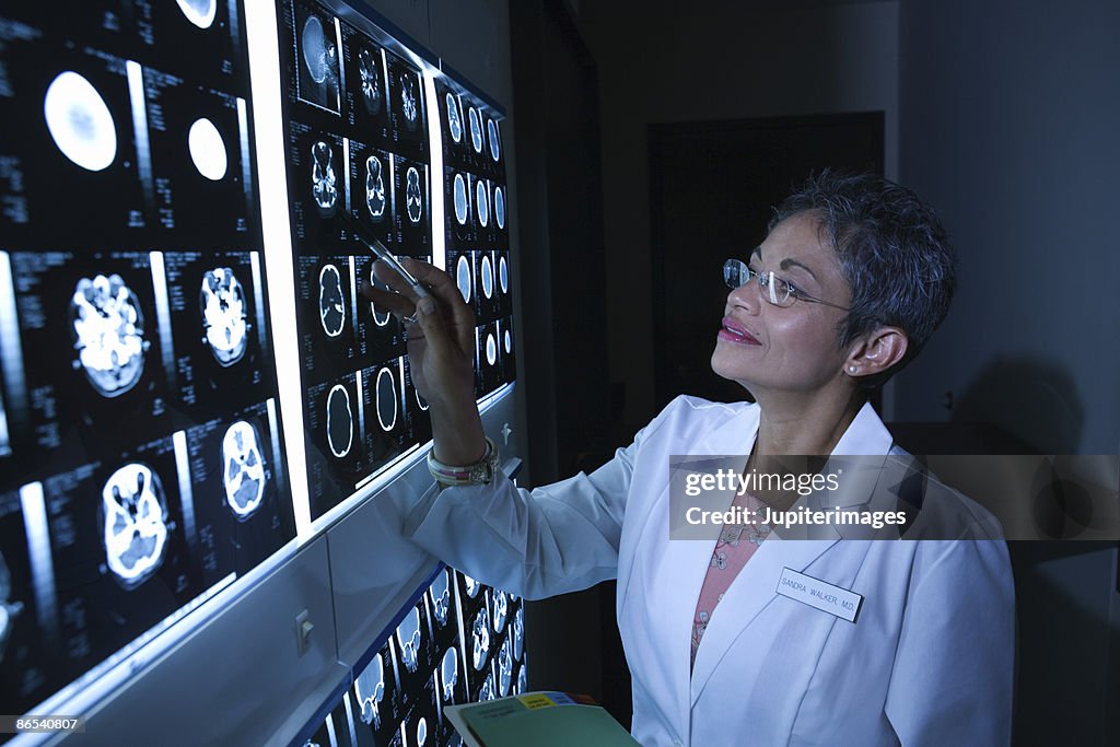 Doctor looking at x-rays
